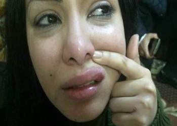 ممثلة مصرية تتهم الشرطة بهتك عرضها والتعدي عليها بعد توقيفها