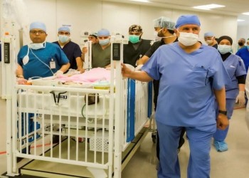 فريق طبي سعودي ينجح في فصل التوأم السيامي اليمني يوسف وياسين