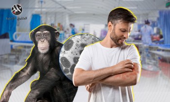 الصحة العالمية: النظافة وضبط السلوك الجنسي كافيان لمواجهة جدري القرود