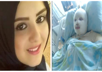 عمها يكشف التفاصيل.. وفاة لبنانية أحرقها زوجها لرفضها إجهاض الجنين