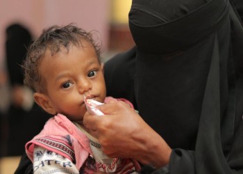 29 مليون دولار منحة أمريكية لحماية أطفال اليمن من سوء التغذية